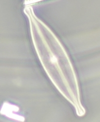 Mikroskooppikuva piilevänäytteestä: Brachysira vitrea -piilevä